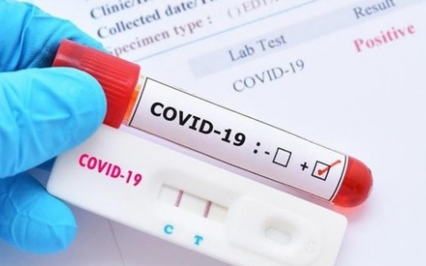 Bộ Y tế đã cấp phép tới 97 loại test xét nghiệm SARS-CoV-2