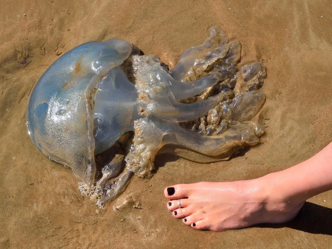 Bị sứa biển cắn: Nguy hiểm bất ngờ khi mùa hè đến không nên coi thường