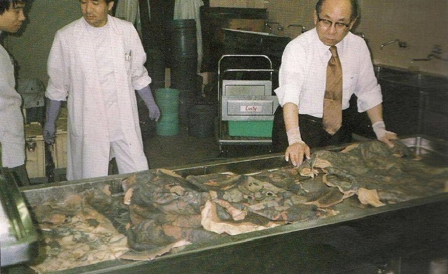 Từ phát hiện xăm mình bằng kim có thể ngăn chặn bệnh giang mai tái phát đến bộ sưu tập tưởng rùng rợn nhưng đầy tính nghệ thuật của bác sĩ người Nhật