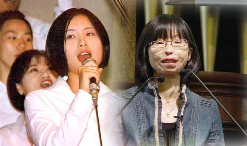Lee Ji Seon đánh bại nghịch cảnh: Từ cô sinh viên bị tai nạn hủy dung đến nữ giảng viên truyền cảm hứng