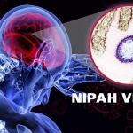 Nơi khởi nguồn của virus Nipah gây bệnh sưng não ở đâu?