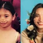 Hành trình phá vỏ bọc tự ti và ước mơ làm người mẫu thời trang nữ sinh trường Luật bị dị tật ở mũi