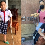Khâm phục sự kiên trì của 'chú lính chì' bị ung thư phải cắt bỏ 1 chân: Luôn ao ước hồi sinh để được đến trường