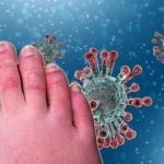 Ngón chân COVID là hiện tượng gì và ngón chân COVID có phải do virus SARS-CoV-2 gây ra không?