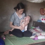 Thương bé trai bị não úng thủy thiếu tình yêu thương của bố, giờ không có tiền phẫu thuật