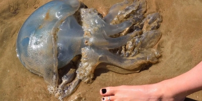 Bị sứa biển cắn: Nguy hiểm bất ngờ khi mùa hè đến không nên coi thường