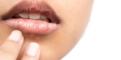 Viền môi bị thâm phải làm sao? Cách trị thâm viền môi hiệu quả