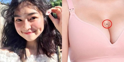 Má lúm đồng tiền, nốt ruồi trước ngực và những dấu hiệu cho thấy một người có tính cách tốt đẹp