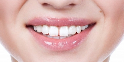 4 kiểu răng phá tướng, ảnh hưởng đến tài lộc của chủ nhân