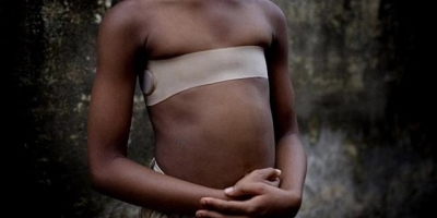 Lạ lùng cách bảo vệ các bé gái khỏi 'yêu râu xanh' ở Cameroon: 'Là phẳng ngực' khi đến tuổi dậy thì