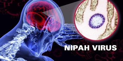 Nơi khởi nguồn của virus Nipah gây bệnh sưng não ở đâu?