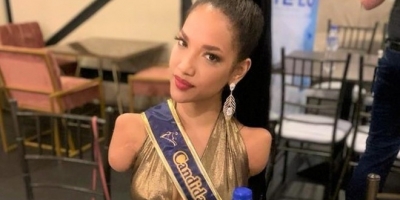 Victoria Salcedo - nữ 'chiến binh' mất 2 tay và 1 chân vào chung kết Hoa hậu Ecuador 2021