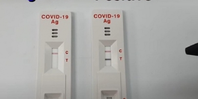 Cách đọc kết quả test nhanh COVID-19 tại nhà chuẩn nhất