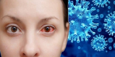 Hậu COVID-19 có thể gặp di chứng gì về mắt?