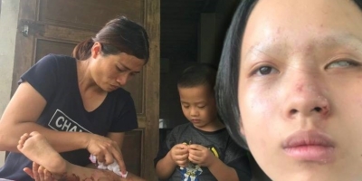 Bệnh tật, tai họa dồn dập đổ xuống, đẩy gia đình nghèo ở xứ Nghệ đến bước đường cùng