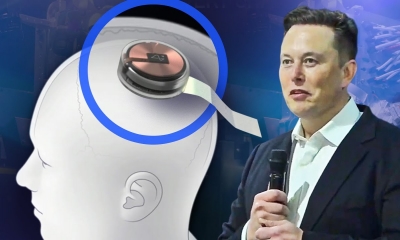 Tham vọng của Elon Musk: Sắp thử nghiệm cấy chip vào não người, là công cụ hữu ích cho người khuyết tật?