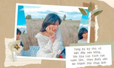 Từng bị kỳ thị vì mặt đầy sẹo bỏng, 10x Gia Lai tích cực vươn lên, theo đuổi ước mơ thành thợ chụp ảnh