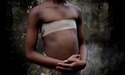 Lạ lùng cách bảo vệ các bé gái khỏi 'yêu râu xanh' ở Cameroon: 'Là phẳng ngực' khi đến tuổi dậy thì