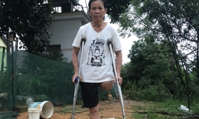 Lời kêu cứu xót xa của người phụ nữ mất 1 chân vì tai nạn lao động