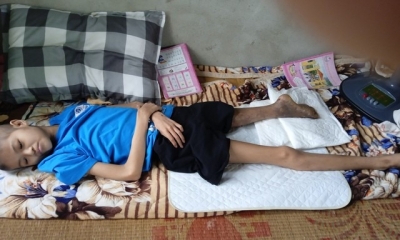 Ước mơ của bé gái bị ung thư xương: Được lắp chân giả để bớt đi sự tự ti