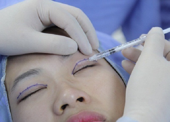 Thiếu nữ 23 tuổi bị mù sau khi đi cắt mí tại một spa ở Hà Nội