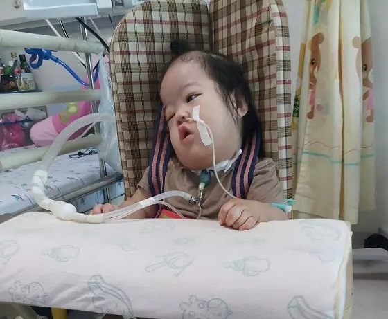 Bảo Ngọc 2 tuổi với 7 lần ngưng thở, lay lắt níu kéo sự sống: Bố mẹ khao khát đưa con ra Hà Nội khám nhưng nghèo quá