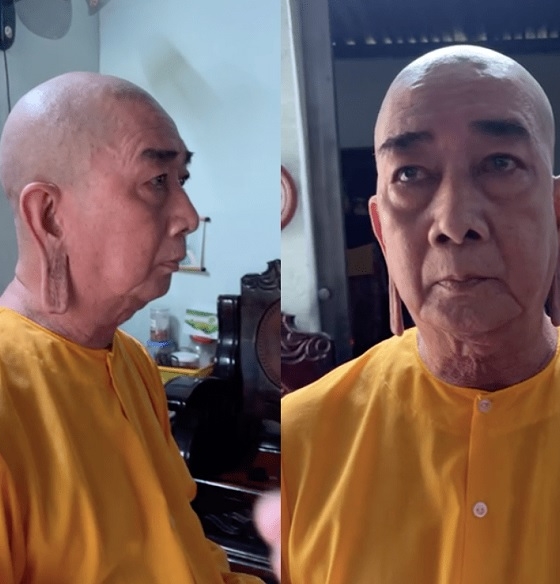 Chuyện chú xe ôm sở hữu đôi tai Phật 'độc nhất vô nhị' ở Việt Nam: Sợ người khác biết sẽ dùng hình ảnh của mình cho mục đích xấu