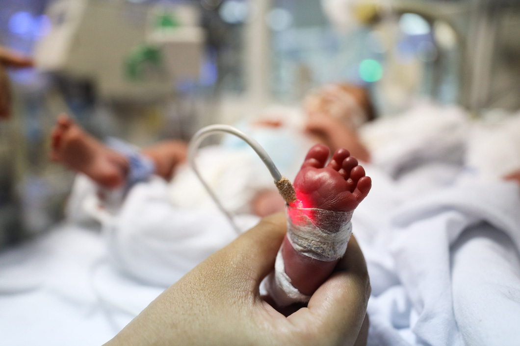 Trẻ sinh non luôn đòi hỏi nhu cầu dinh dưỡng bổ sung. Chính vì thế, sữa cho trẻ sinh non, nhẹ cân cần phải là nguồn dinh dưỡng tốt nhất để hỗ trợ trẻ (Ảnh: Internet). trẻ sinh non