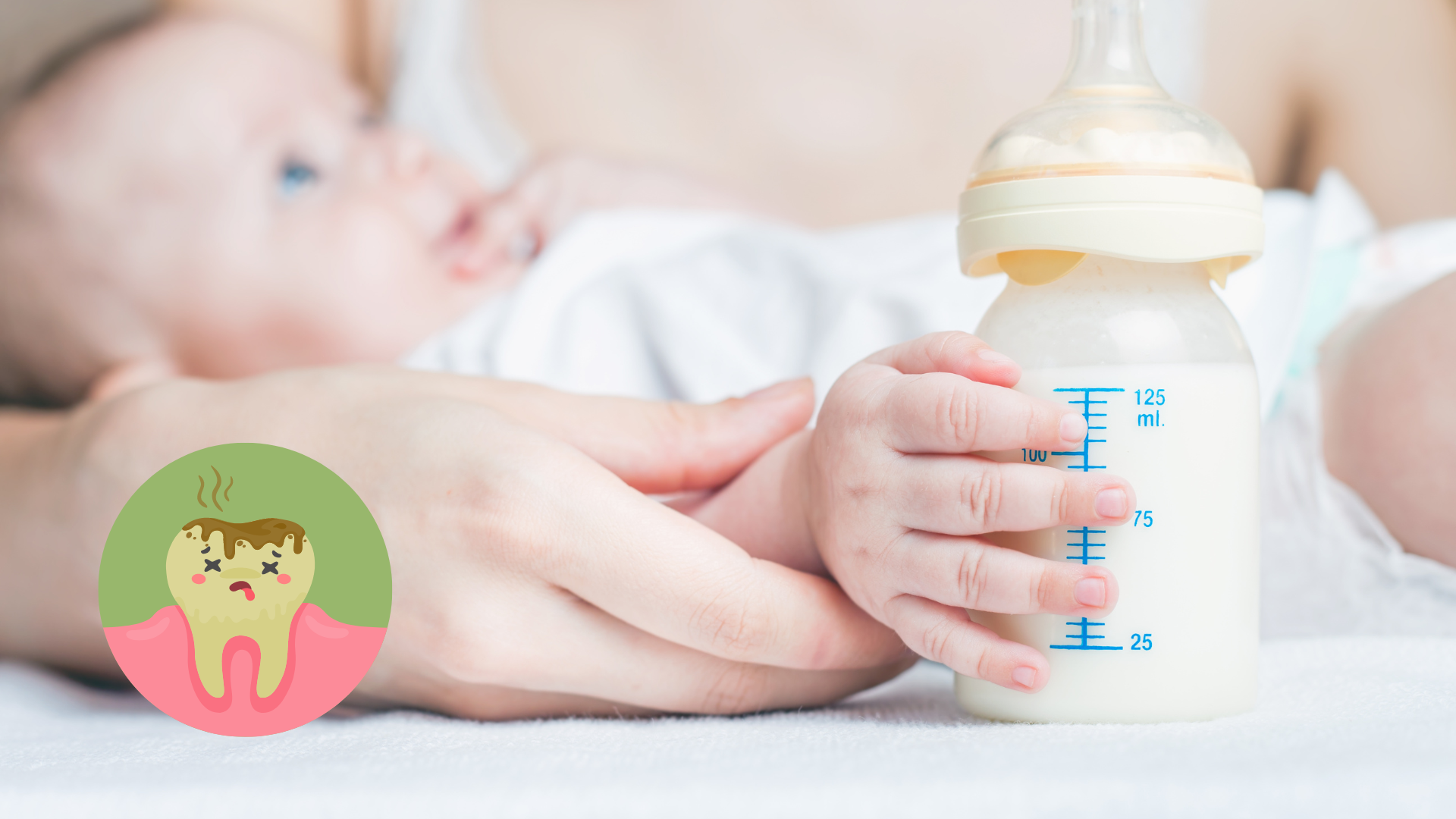 Theo bác sĩ Hồng Duyên, hội chứng sâu răng do bú bình là bệnh thường gặp ở trẻ hơn so với trước kia (Ảnh: Internet). sâu răng
