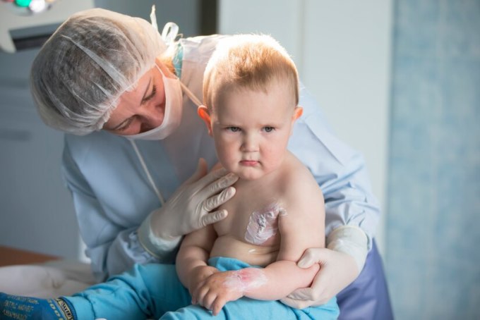 Bé bị bỏng cần được chăm sóc đặc biệt. Ảnh: Freepik little-boy-nurse-treats-burn-c-1437-2648-1658464241