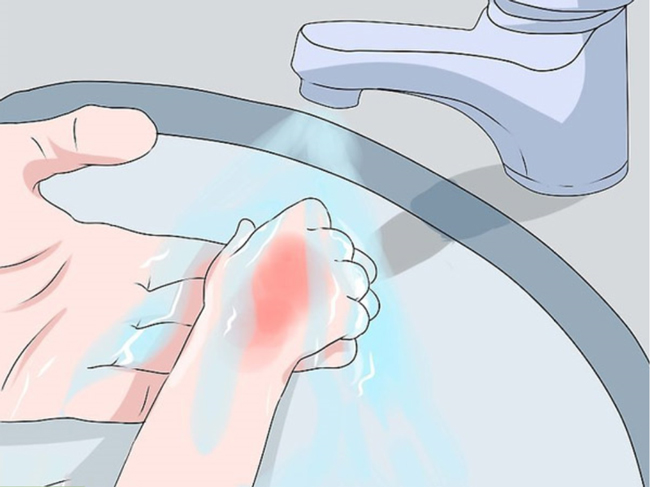 Ảnh minh họa. Nguồn: BV Nhi TƯ thuocnam