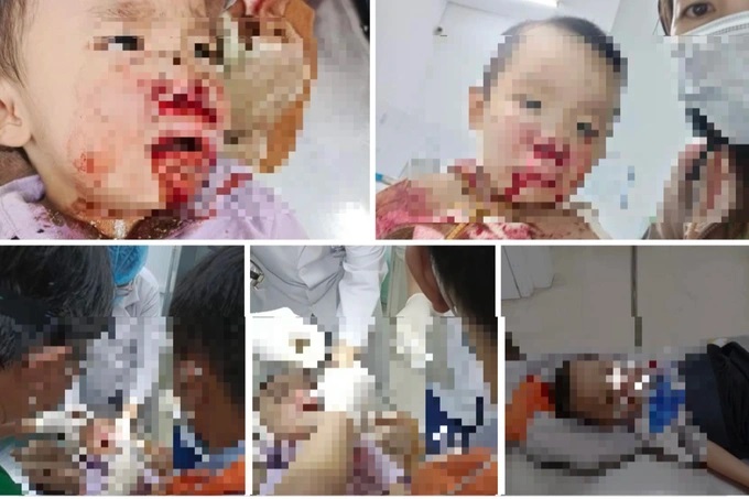 Hình ảnh trên mạng xã hội cho rằng CSGT đánh trúng bé trai (Ảnh: FB chị S.) img20221028102121-edited-1666927608633