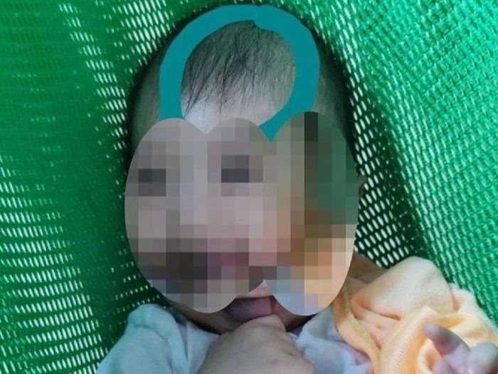 Cập nhật tình trạng sức khỏe của bé trai 6 tháng tuổi bị bảo mẫu đánh dập não