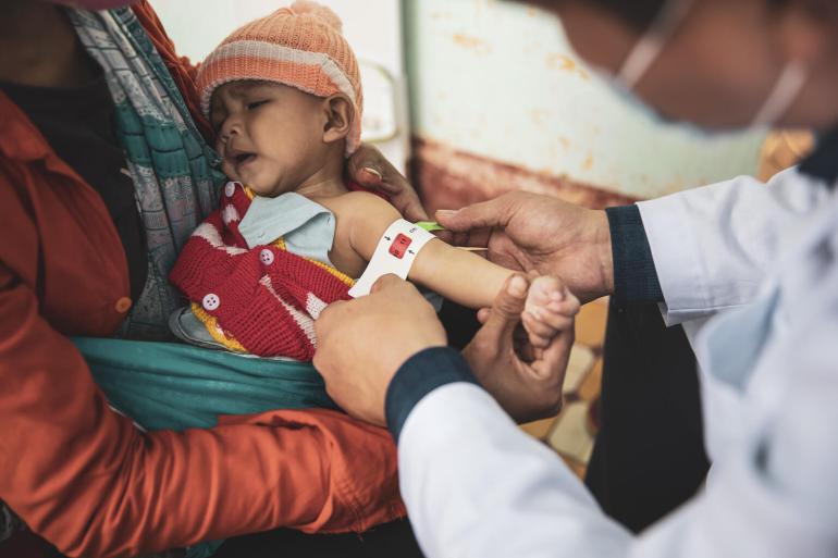 90% trẻ em bị suy dinh dưỡng cấp tính nặng ở Việt Nam không được điều trị