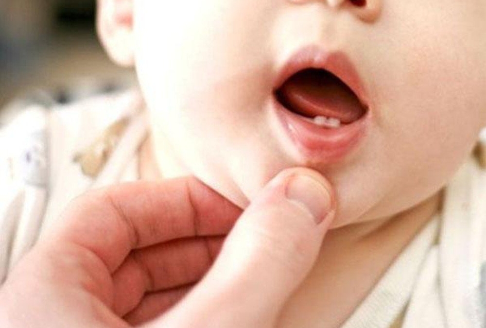 Cách chăm sóc nướu và răng mới mọc của trẻ
